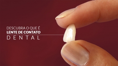 Lente de contato dental para um sorriso de estrela