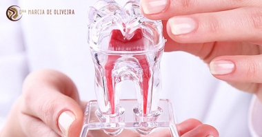 O que é Desvitalização Dentária?